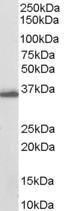 Anti-AKR1C3 Antibody (A84062) (0.03 µg/ml) staining of human breast lysate (35 µg protein in RIPA buffer). Primary incubation was 1 hour. Detected by chemiluminescence