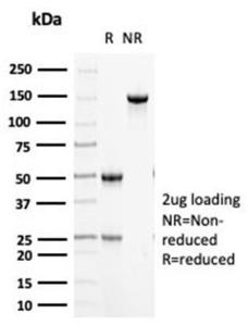 SDS-PAGE analysis of Anti-Cytokeratin 5 Antibody [KRT5/6466] under non-reduced and reduced conditions; showing intact IgG and intact heavy and light chains, respectively. SDS-PAGE analysis confirms the integrity and purity of the antibody