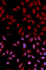 Immunofluorescence analysis of U2OS cells using Anti-HURP Antibody (A11516). DAPI was used to stain the cell nuclei (blue)