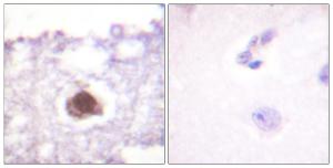 Immunohistochemical analysis of paraffin-embedded human brain tissue using Anti-DNA-PK Antibody. The right hand panel represents a negative control, where the antibody was pre-incubated with the immunising peptide.