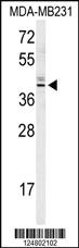 Anti-OR8K3 Rabbit Polyclonal Antibody