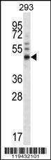 Anti-FOXA1 Rabbit Polyclonal Antibody (APC (Allophycocyanin))