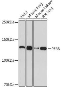 Anti-PER3 antibody