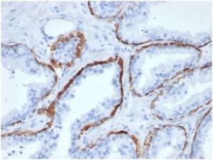 Immunohistochemical analysis of formalin-fixed, paraffin-embedded human prostate tissue using Anti-Cytokeratin 5 Antibody [KRT5/6466]