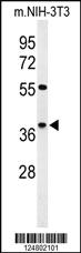 Anti-KLDC2 Rabbit Polyclonal Antibody