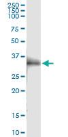 Anti-OLR1 Polyclonal Antibody Pair