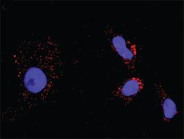 Anti-TP53 + TP53 Antibody Pair