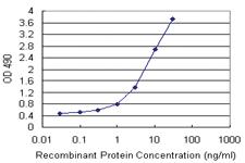 Anti-OPTN Polyclonal Antibody Pair