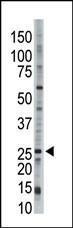 Anti-UBE2E3 Rabbit Polyclonal Antibody (PE (Phycoerythrin))