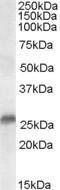 Anti-SRD5A2 Antibody (A84064) (0.3µg/ml) staining of Human Prostate lysate (35µg protein in RIPA buffer). Primary incubation was 1 hour. Detected by chemiluminescence.