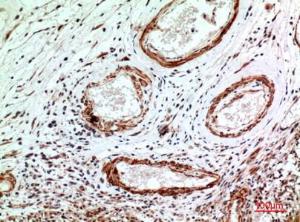 Immunohistochemical analysis of paraffin-embedded human brain using Anti-IL1R1 Antibody