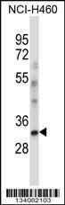 Anti-CEBPE Rabbit Polyclonal Antibody (FITC (Fluorescein Isothiocyanate))