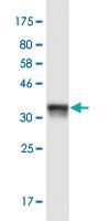 Anti-REG1A Mouse Monoclonal Antibody [clone: 5F8]