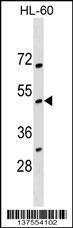 Anti-NOXO1 Rabbit Polyclonal Antibody (HRP (Horseradish Peroxidase))