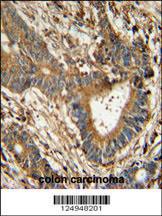 Anti-PCLI1 Rabbit Polyclonal Antibody (Biotin)