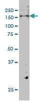 Anti-ERBB3 Mouse Monoclonal Antibody [clone: 2E9]