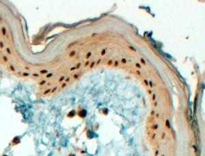 Anti-TFAP2C Antibody (A84066) (4 µg/ml) staining of paraffin embedded Human Skin. Steamed antigen retrieval with Tris/EDTA buffer pH 9, HRP-staining