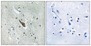 Antibody anti-ROBO2 100 µg