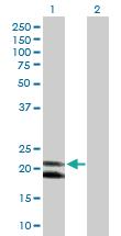 Anti-IFNA4 Rabbit Polyclonal Antibody