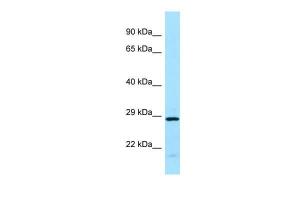 Anti-EIF3J Rabbit Polyclonal Antibody