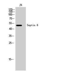 Western blot analysis of JK cells using Anti-SEPT6 Antibody