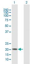 Anti-IFNA5 Rabbit Polyclonal Antibody