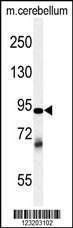 Anti-ZRANB1 Rabbit Polyclonal Antibody