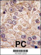 Anti-PI 4 Kinase Type 2 beta Rabbit Polyclonal Antibody