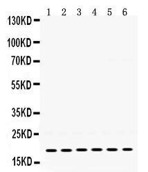 Anti-PTP4A2 Rabbit Polyclonal Antibody