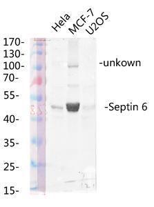 Western blot analysis of various lysis using Anti-SEPT6 Antibody