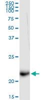 Anti-IFNA5 Rabbit Polyclonal Antibody