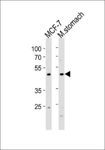 Anti-FOXA2 Rabbit Polyclonal Antibody (FITC (Fluorescein Isothiocyanate))