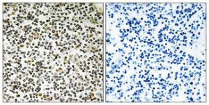 Immunohistochemical analysis of paraffin-embedded human lymph node tissue using Anti-CEP152 Antibody. The right hand panel represents a negative control, where the Antibody was pre-incubated with the immunising peptide