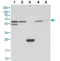 Anti-SPATA18 Rabbit Polyclonal Antibody