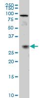 Anti-TGIF2 Mouse Monoclonal Antibody [clone: 5B11]