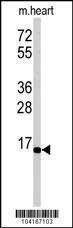 Anti-UBE2G1 Rabbit Polyclonal Antibody (PE (Phycoerythrin))