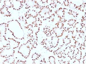 Anti-Cyclin D1 Mouse Monoclonal Antibody [clone: CCND1/2593]