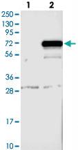 Anti-MAGEE2 Rabbit Polyclonal Antibody