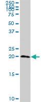 Anti-TSEN15 Rabbit Polyclonal Antibody