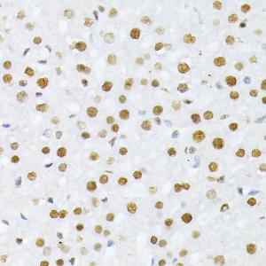 Immunohistochemistry analysis of paraffin-embedded rat liver using Anti-Histone H2A (phospho Ser129) Antibody (A306364) at a dilution of 1:100 (40X lens)