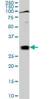 Anti-TGIF2 Mouse Monoclonal Antibody [clone: 5B11]