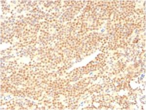 Anti-Cyclin D1 Mouse Monoclonal Antibody [clone: CCND1/2593]