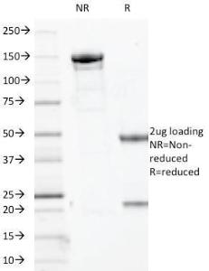 SDS-PAGE analysis of Anti-p63 Antibody [TP63/2427] under non-reduced and reduced conditions; showing intact IgG and intact heavy and light chains, respectively. SDS-PAGE analysis confirms the integrity and purity of the antibody.