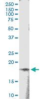 Anti-TSEN15 Rabbit Polyclonal Antibody