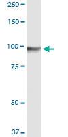 Anti-GTSE1 Polyclonal Antibody Pair