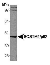 Anti-P62 Rabbit Polyclonal Antibody