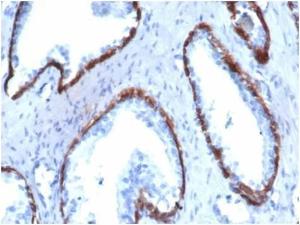 Immunohistochemical analysis of formalin-fixed, paraffin-embedded human prostate tissue using Anti-Cytokeratin 14 Antibody [KRT14/4130] at 2µg/ml