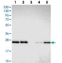 Anti-GDF6 Rabbit Polyclonal Antibody