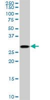 Anti-TGIF2 Mouse Monoclonal Antibody [clone: 5B11]