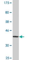 Anti-USP9X Mouse Monoclonal Antibody [clone: 5D7]